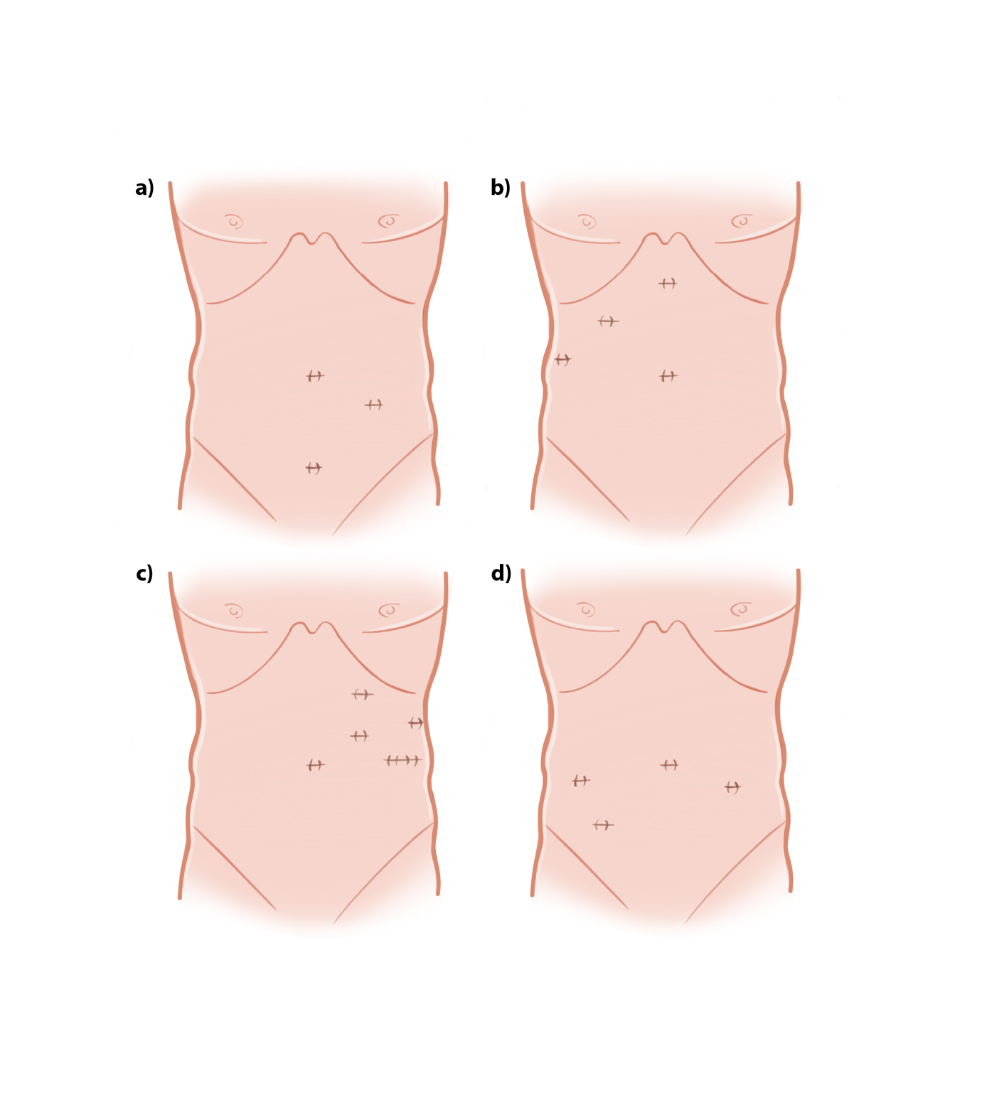 A diagram of a person's body

AI-generated content may be incorrect.