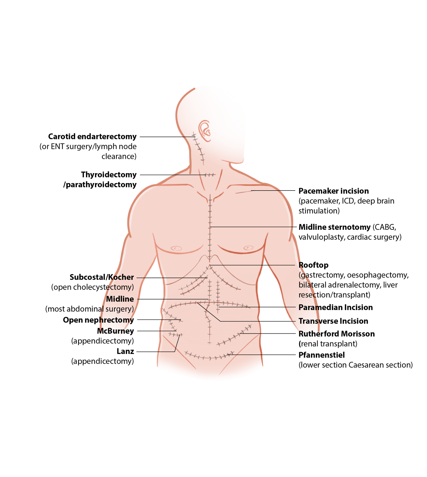 A diagram of a person's body

AI-generated content may be incorrect.
