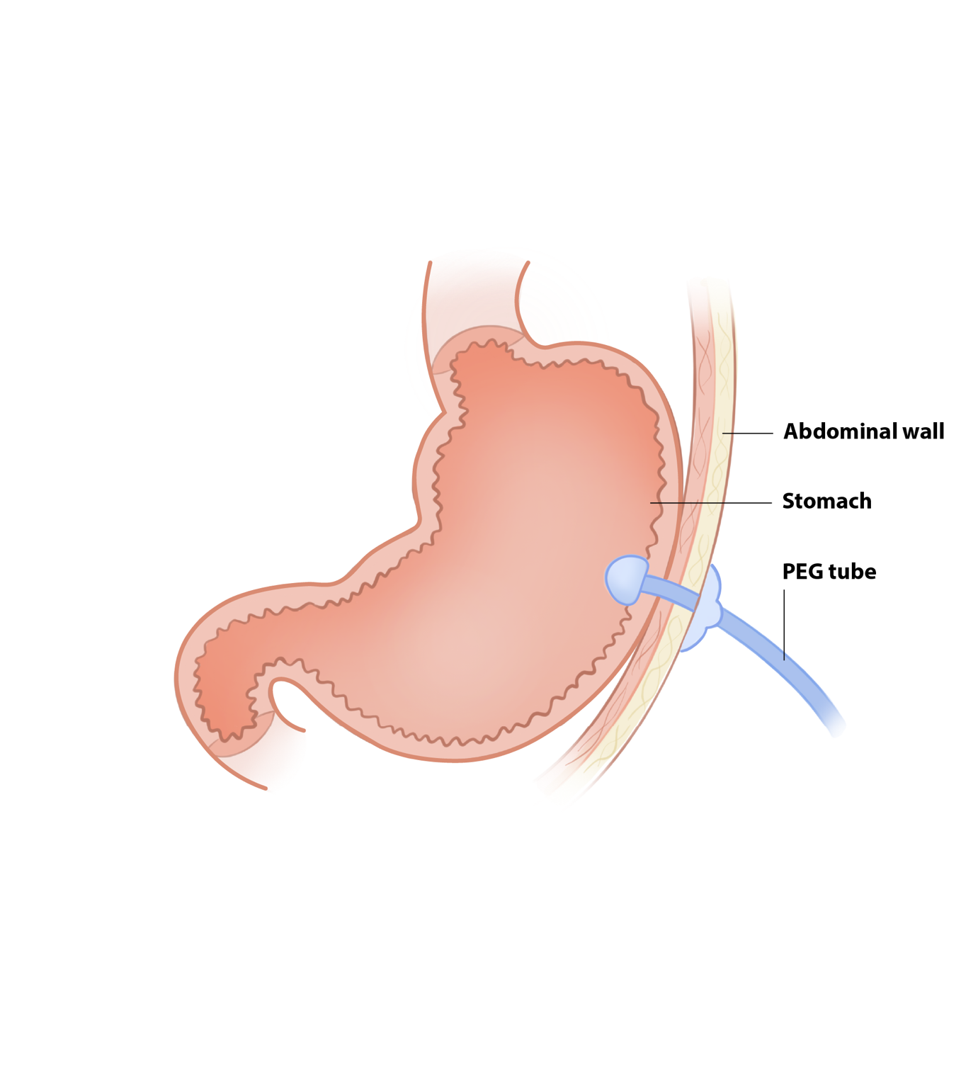 A diagram of a stomach

AI-generated content may be incorrect.