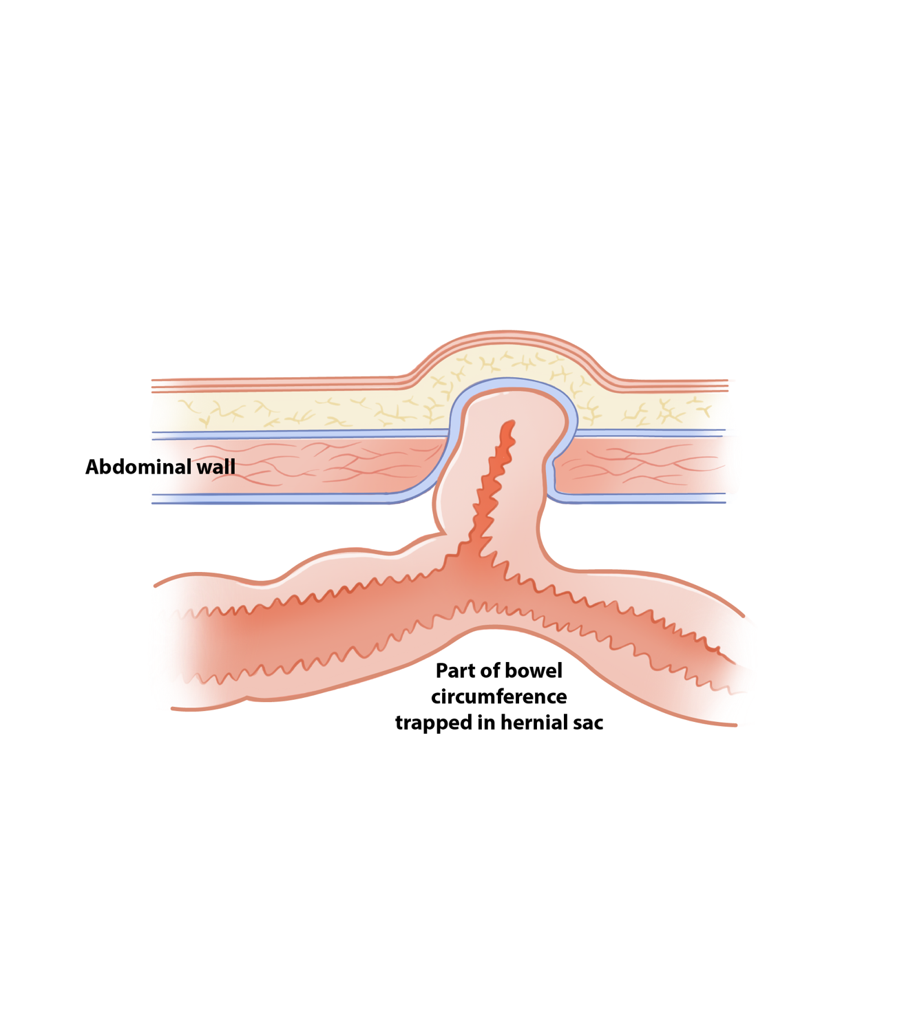 A diagram of a circumference of a human body

AI-generated content may be incorrect.